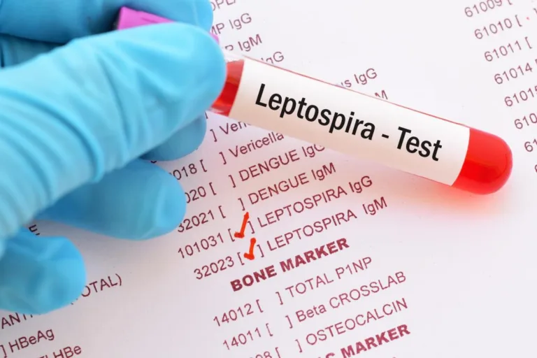 The NIH advises health officials to watch for leptospirosis.